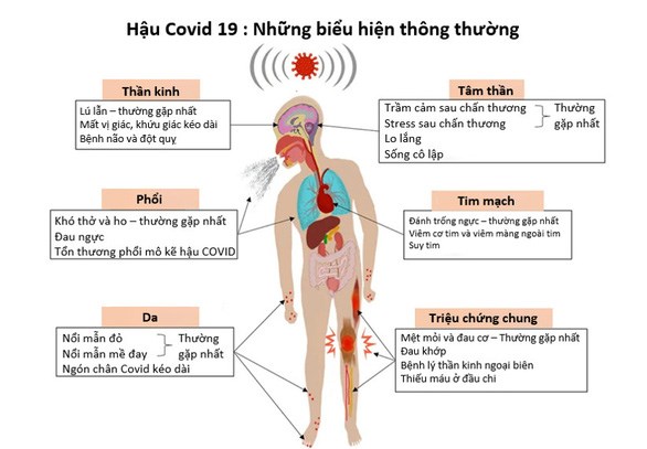 hình minh họa 1
